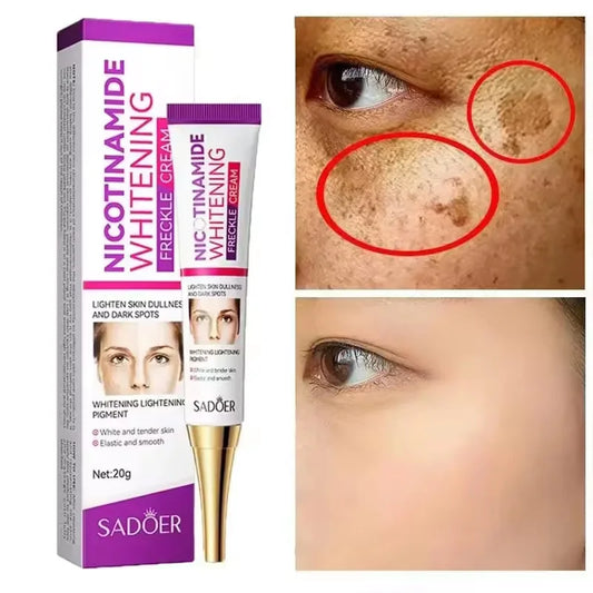 SADOER Freckle Removing Cream — Nicotinamide Moisturizing Face Cream for Hydrating, Nourishing & Firming Skin