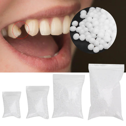 Temporary Tooth Repair Beads – Dental Filling Material for Broken or Missing Teeth