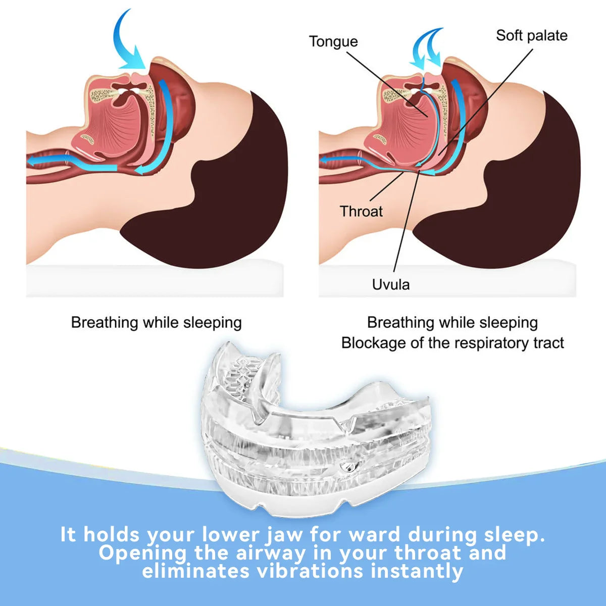 Adjustable Anti-Snoring Mouth Guard – Sleep Aid Mouthpiece for Bruxism, Anti-Apnea & Snoring Relief