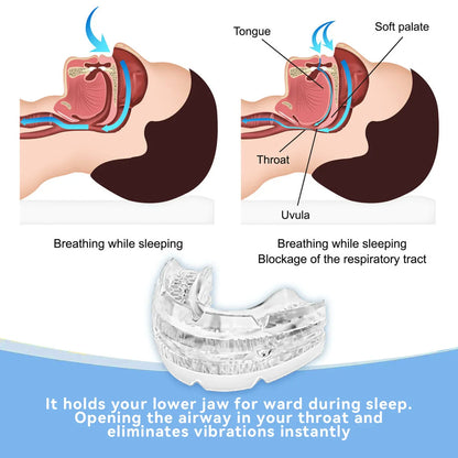 Adjustable Anti-Snoring Mouth Guard – Sleep Aid Mouthpiece for Bruxism, Anti-Apnea & Snoring Relief