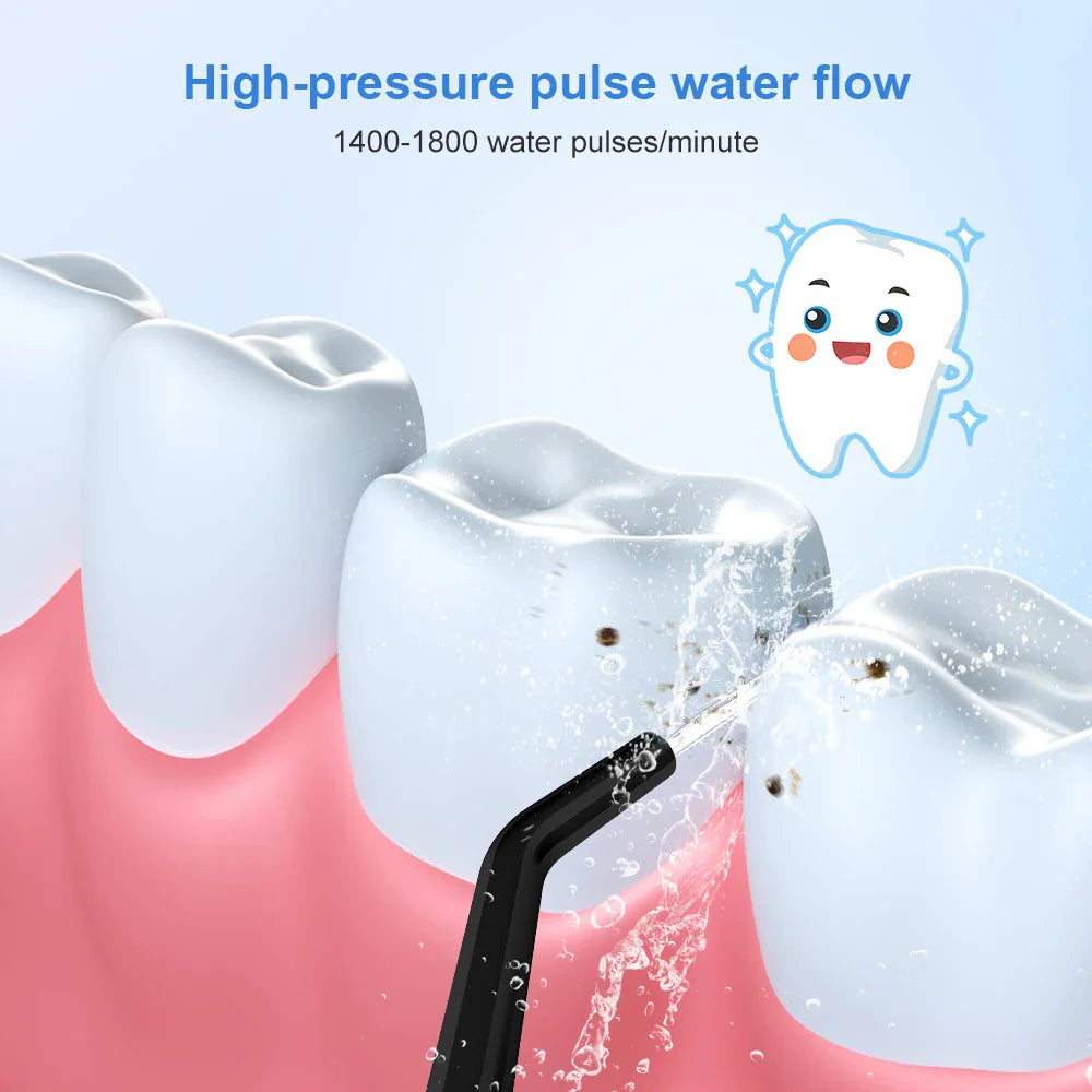 INSMART Portable Oral Irrigator – 300ml Waterproof Dental Water Flosser for Teeth Cleaning & Whitening