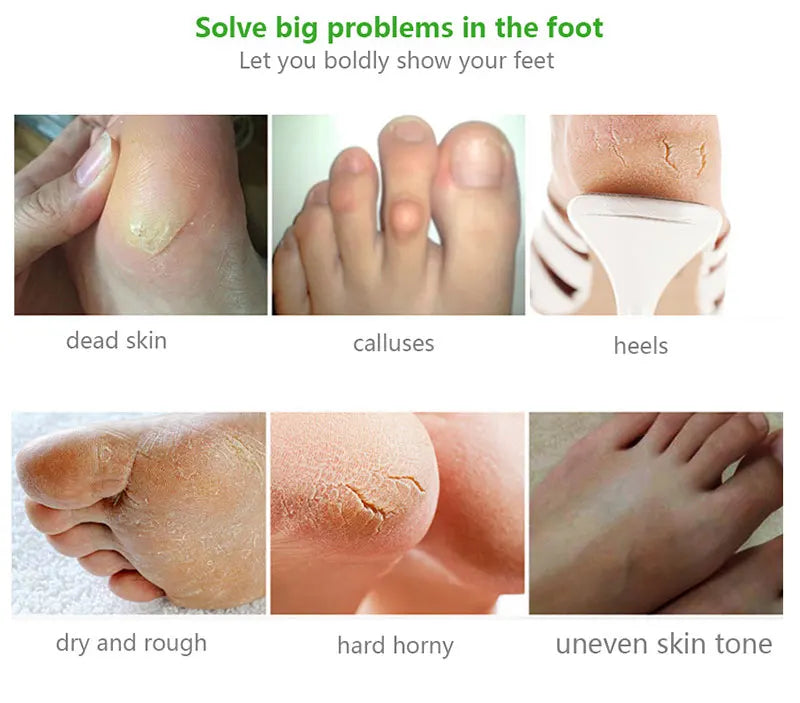 Exfoliating Foot Mask & Pedicure Socks – Dead Skin Removal, Whitening Foot Care, Foot Spa Scrub & Skin Refreshment