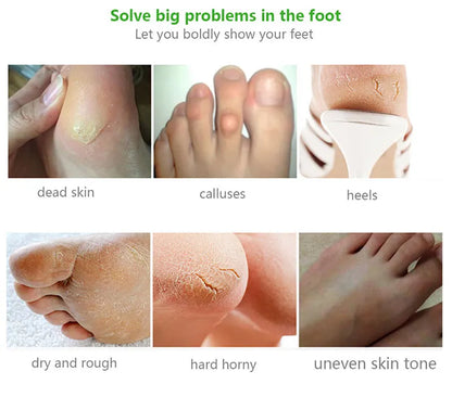 Exfoliating Foot Mask & Pedicure Socks – Dead Skin Removal, Whitening Foot Care, Foot Spa Scrub & Skin Refreshment