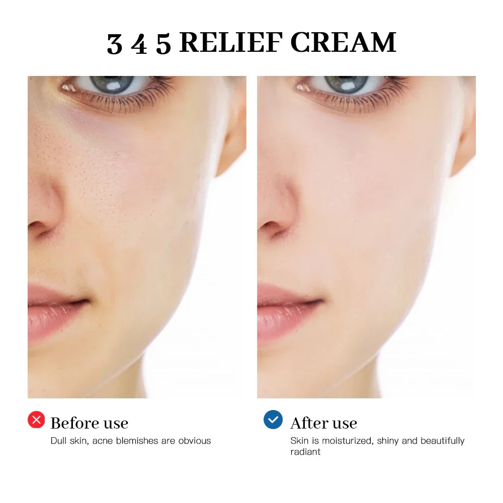 345 Relief Cream – Soothing Skincare Solution to Address Blemishes, Nourish Skin & Promote Healthy Complexion