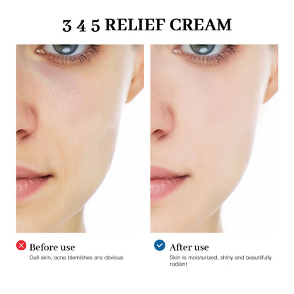345 Relief Cream – Soothing Skincare Solution to Address Blemishes, Nourish Skin & Promote Healthy Complexion