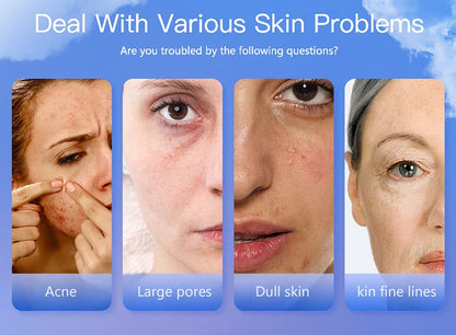 LCD Digital Skin Analyzer Pen — Face Tester for Moisture, Oil & Skin Health with Fluorescent Display