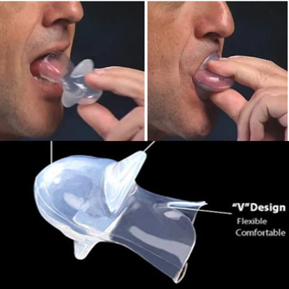 Medical Silicone Anti-Snore Tongue Retainer – Apnea Aid Mouthpiece for Snoring Relief