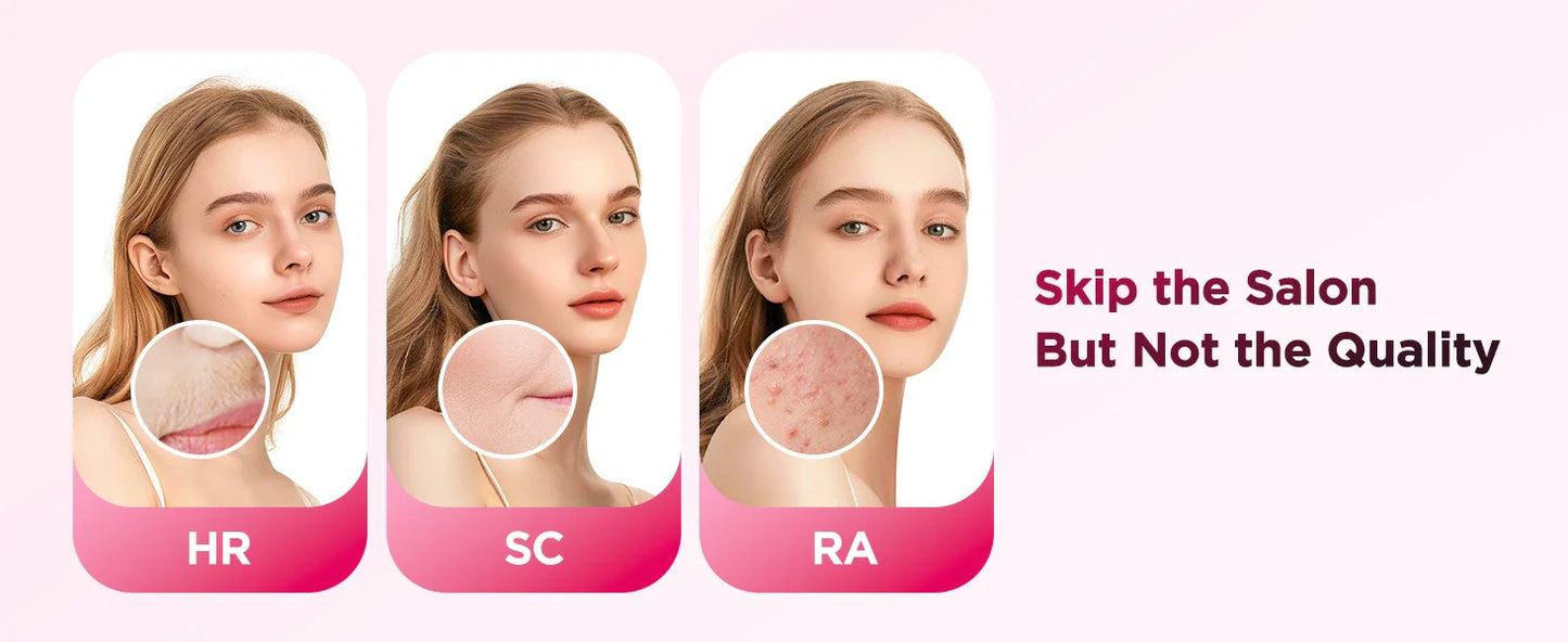 990,000 Flash IPL Laser Epilator — Permanent Painless Hair Removal for Men & Women, Body & Bikini