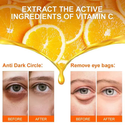 Anti-Dark Circle Eye Serum — Retinol Oil for Wrinkle Removal, Firming, Eye Bag Reduction, Fine Line Fading & Brightening Korean Eye Care