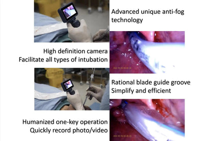 3.5-Inch Touch Screen Video Laryngoscope with Reusable Sterilizable Blades – Digital Laryngoscope, Mexico Warehouse Delivery