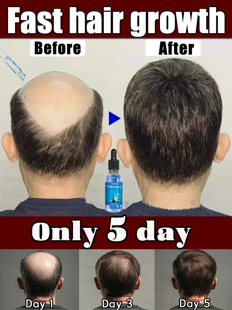 WPRBREGT Blue Hair Growth Serum — Essential Oil for Thicker Hair, Anti-Baldness Treatment
