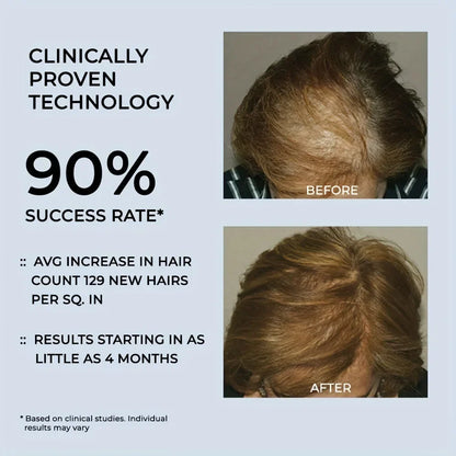 180pcs Red Light Hair Regrowth Cap – 850nm & 660nm Near-Infrared Light for Oil Control, Strengthening Hair Roots & Anti-Hair Loss