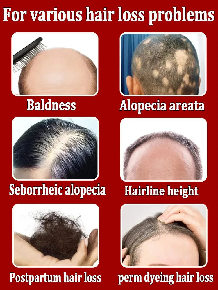 2024 Expert-Approved Hair Growth Essential Oil - Effective Baldness Repair and Hair Restoration