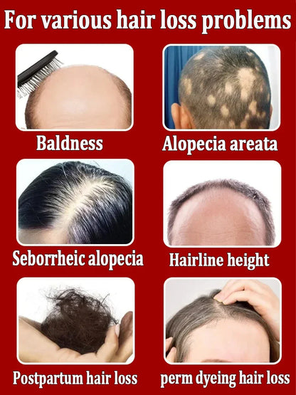 2024 Expert-Approved Hair Growth Essential Oil - Effective Baldness Repair and Hair Restoration