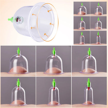 12/24-Cup Chinese Vacuum Cupping Therapy Set – Pull-Out Suction Massager for Pain Relief & Muscle Relaxation
