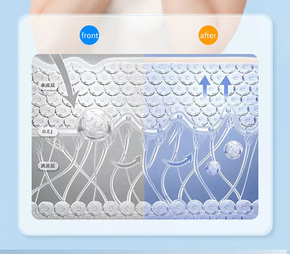 EMS Face Lifting Massager – Anti-Wrinkle, Firming V-Face Lift Microcurrent Device for Double Chin Skin Care