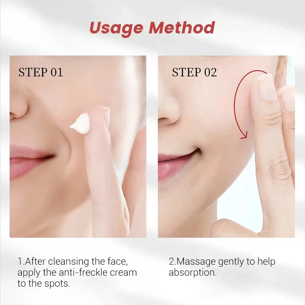 Niacinamide Whitening Freckle Cream – Anti Dark Spot, Melasma & Pigmentation Removal Anti-Aging Skin Brightening Cream (1/3/5pcs)