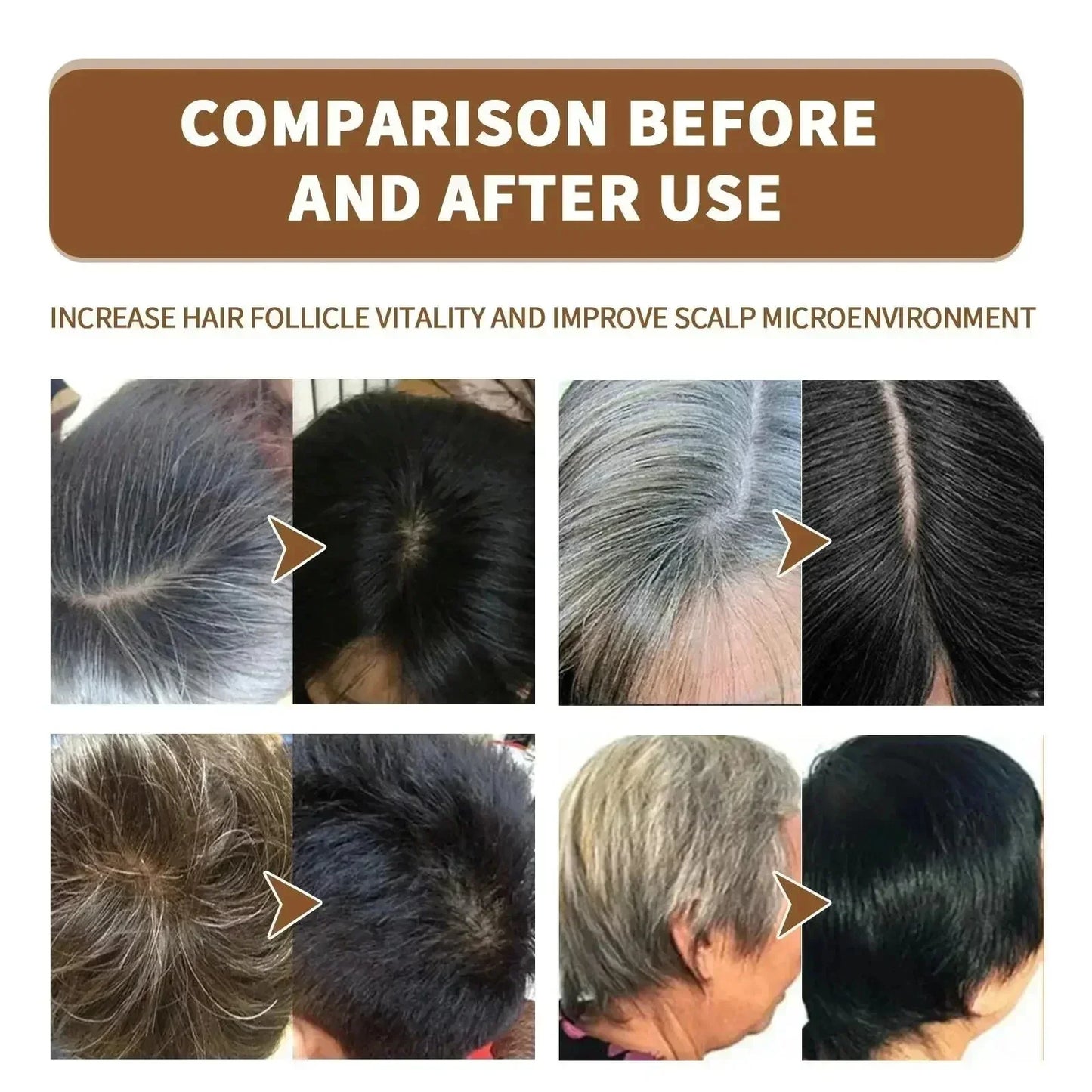 White Hair Remover – Restore Natural Hair Color in 7 Days, Gray Hair Treatment Solution