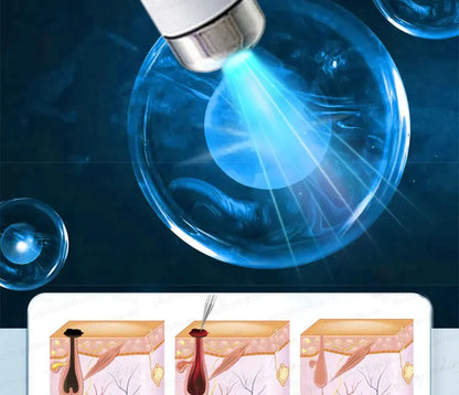 Safe Skin-Friendly Wart Removal Methods – Gentle Solutions for Effective Wart Treatment
