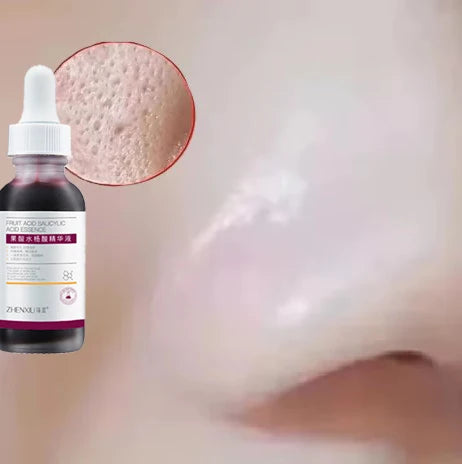Salicylic Acid Skincare Essence – Deep Hydration Care Serum, Soothes Redness, Refines Skin Texture & Smooths Complexion for Daily Gentle Nourishment