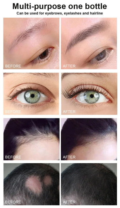 Eyebrow & Eyelash Growth Serum – Fast-Growing, Hair Loss Prevention Treatment for Fuller, Thicker Lashes and Brows