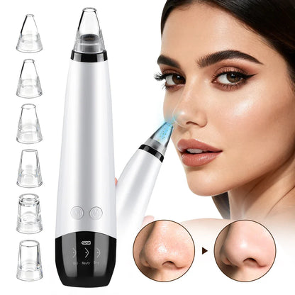 3-Mode Blackhead Remover Vacuum – Facial Pore Cleaner & Dead Skin Removal Beauty Tool