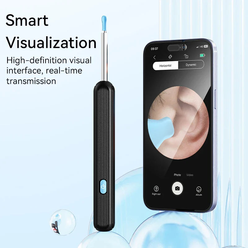 Wireless Ear Wax Cleaner with Camera – Safe Earwax Removal Endoscope with LED Light, Ear Cleaning Tool for Ear Care