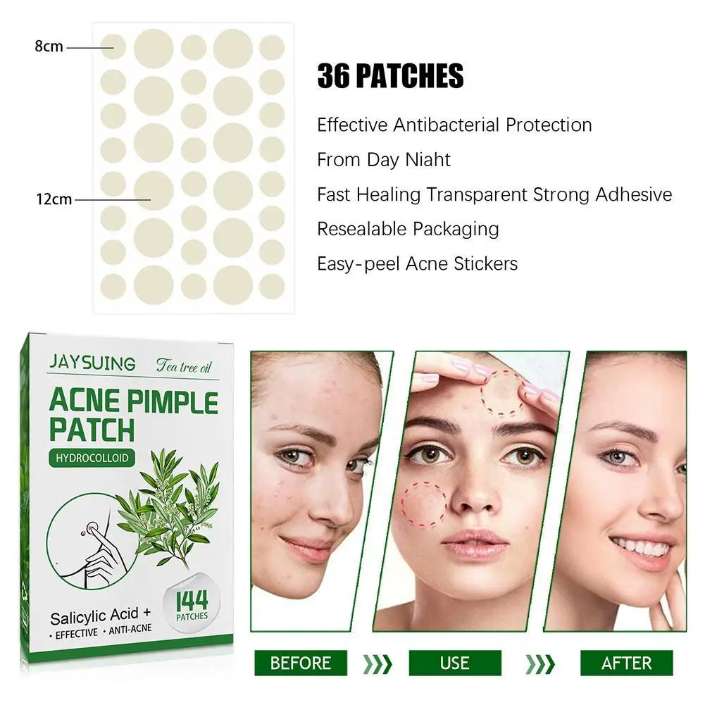144 Pack Acne Pimple Patches – Translucent Matte Hydrocolloid with Salicylic Acid & Tea Tree Oil for Whiteheads & Inflamed Acne