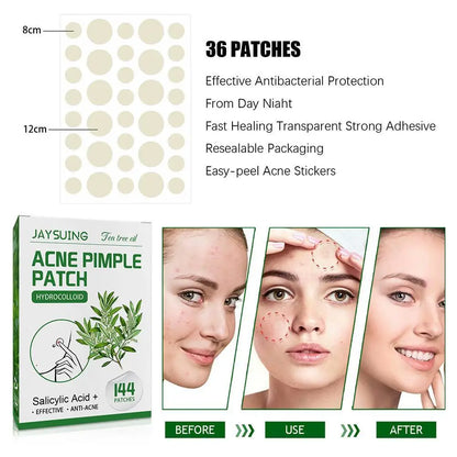 144 Pack Acne Pimple Patches – Translucent Matte Hydrocolloid with Salicylic Acid & Tea Tree Oil for Whiteheads & Inflamed Acne