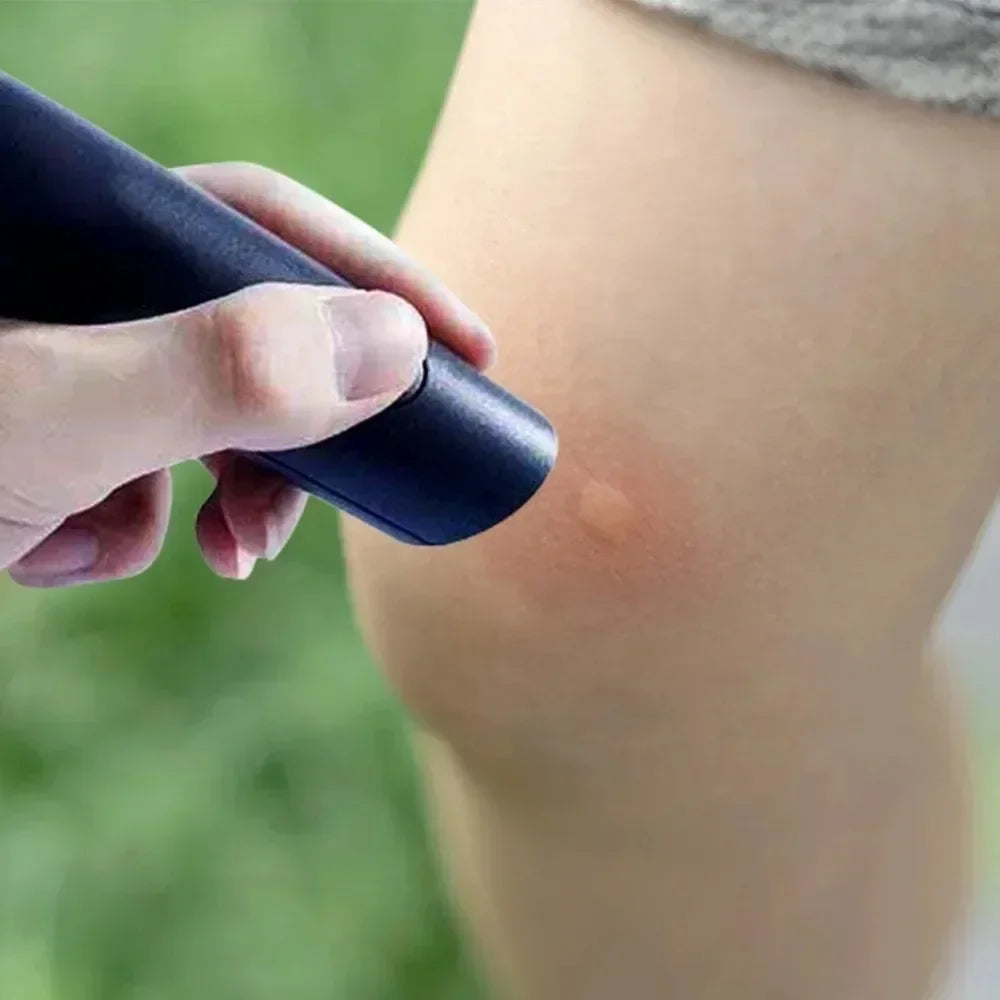 Electronic Mosquito Bite Relief Pen - Portable Insect Sting Itch & Swelling Soother for Outdoor Camping and Travel