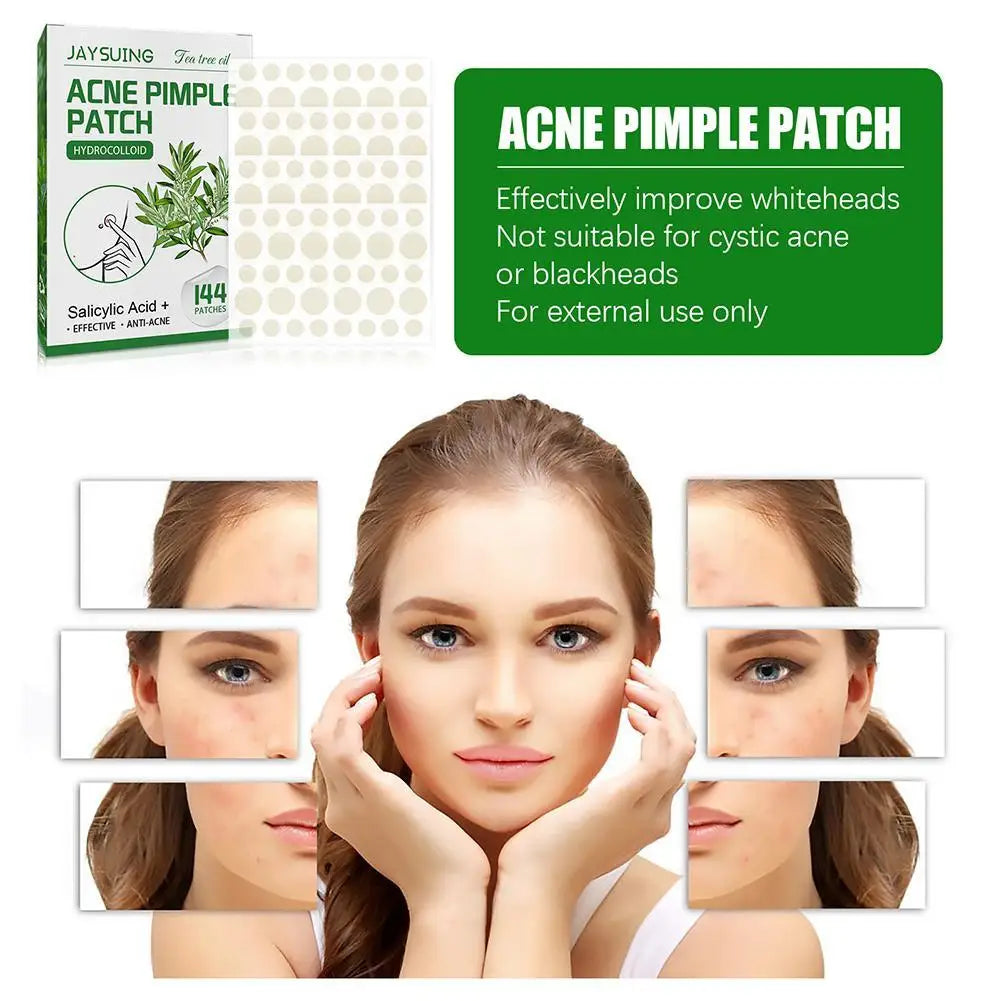 144 Pack Acne Pimple Patches – Translucent Matte Hydrocolloid with Salicylic Acid & Tea Tree Oil for Whiteheads & Inflamed Acne