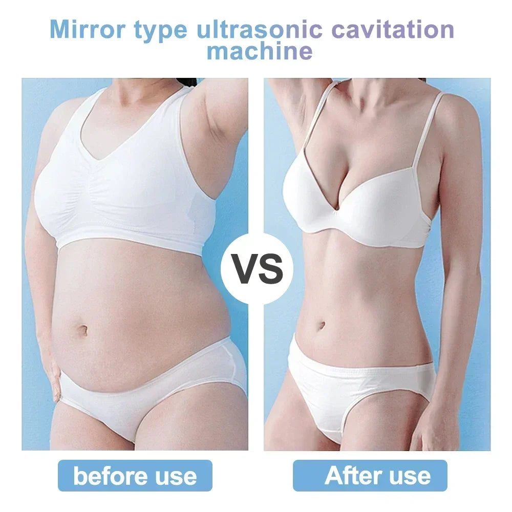 40K Ultrasonic Cavitation Machine – Body Slimming & Facial Lifting RF Beauty Massager for Weight Loss