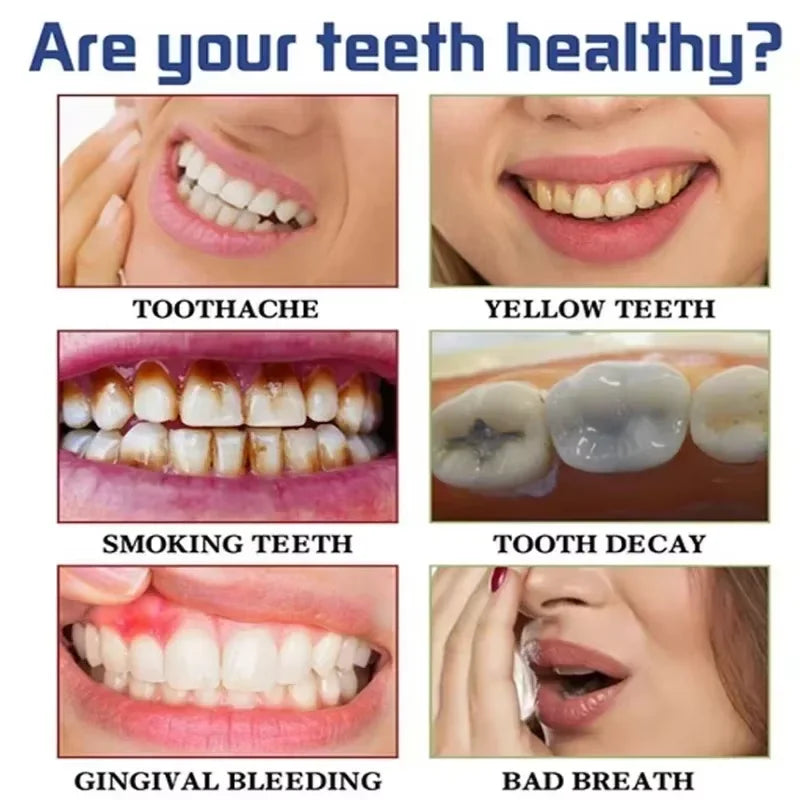 SP-10 Fresh Breath & Whitening Toothpaste – Removes Plaque, Yellow Stains & Supports Gum Health for Oral Care