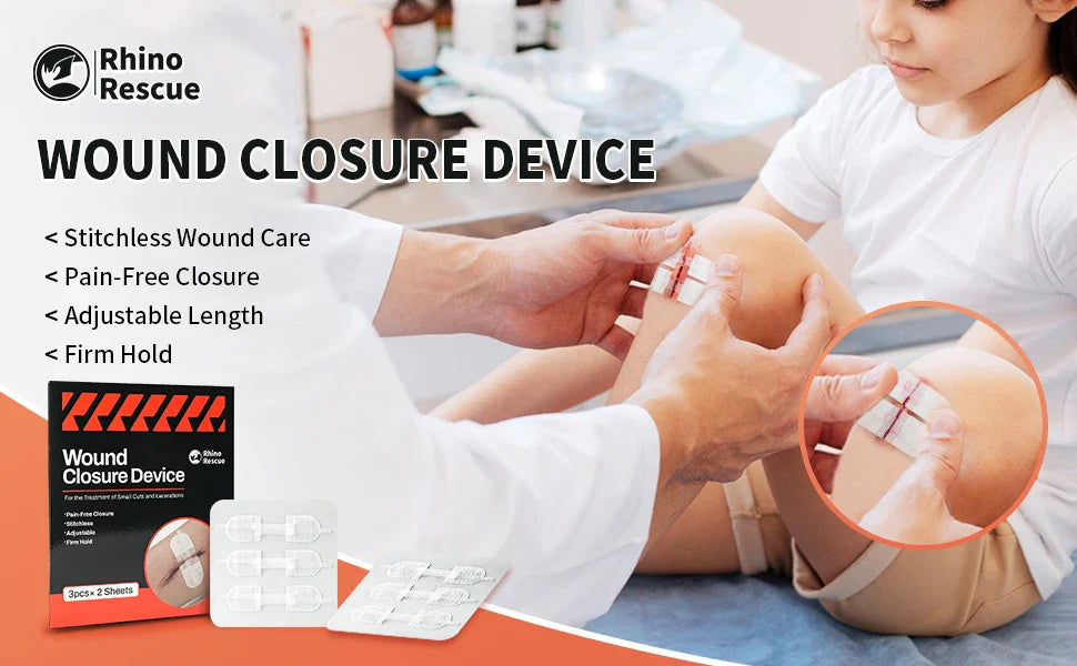 RHINO RESCUE Zip Stitch — Wound Closure Strips, Adhesive Bandages for Cut Care Without Sutures