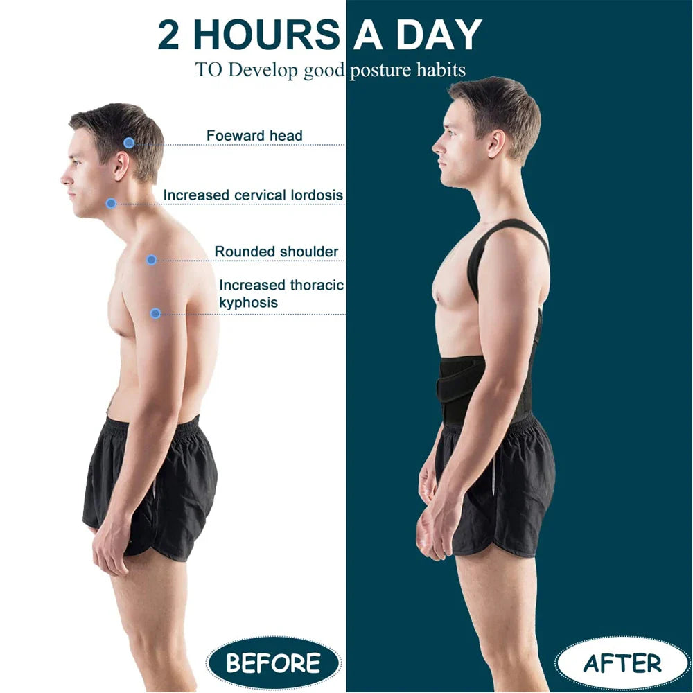 Back Brace Posture Corrector — Adjustable Back Straightener for Women & Men | Scoliosis & Hunchback Correction Posture Trainer