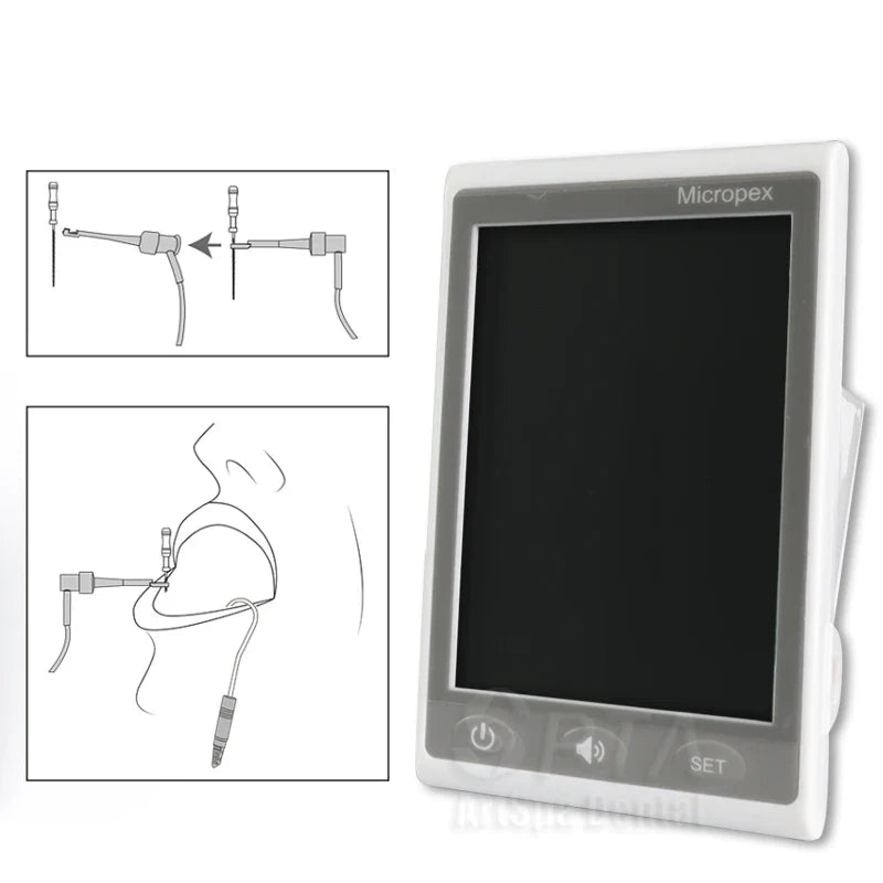 Mini Dental Apex Locator – Battery-Free Endodontic Root Canal Measuring Tool for Oral Treatment