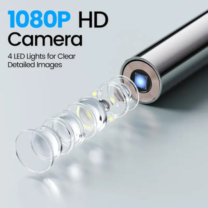 Smart Ear Camera Endoscope – 1080P HD Ear Cleaning Tool with 90° Rotatable Lens & 12 Replacement Heads for Ear, Nose & Skin Inspection