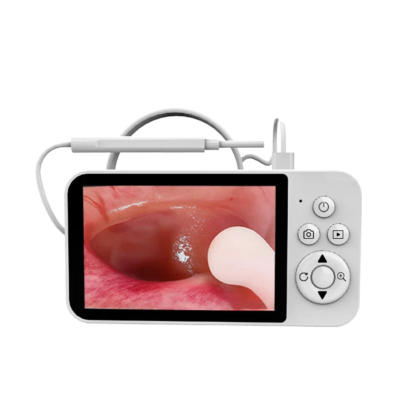 DDCAMERA 4.3" Digital Otoscope – 1080P Ear Scope with 6 LED Lights for Ear Wax Removal, Photo & Video Support