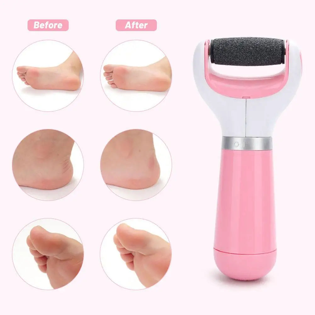 Electric Callus Remover & Dead Skin Trimmer – Professional Foot Grinder Pedicure Tool for Smooth Foot Care