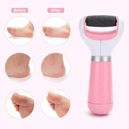 Electric Callus Remover & Dead Skin Trimmer – Professional Foot Grinder Pedicure Tool for Smooth Foot Care