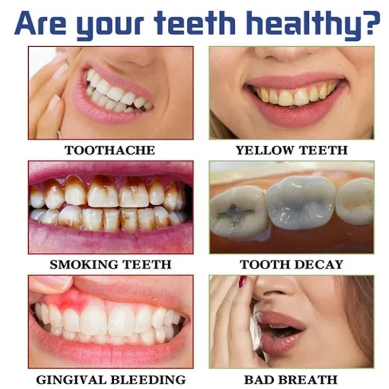 Teeth Whitening Toothpaste – Fruit Acid Formula for Plaque Removal, Stain & Calculus Cleanser, Fresh Breath & Oral Hygiene