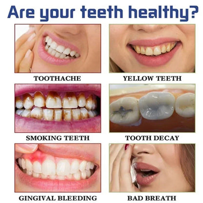 Teeth Whitening Toothpaste – Fruit Acid Formula for Plaque Removal, Stain & Calculus Cleanser, Fresh Breath & Oral Hygiene
