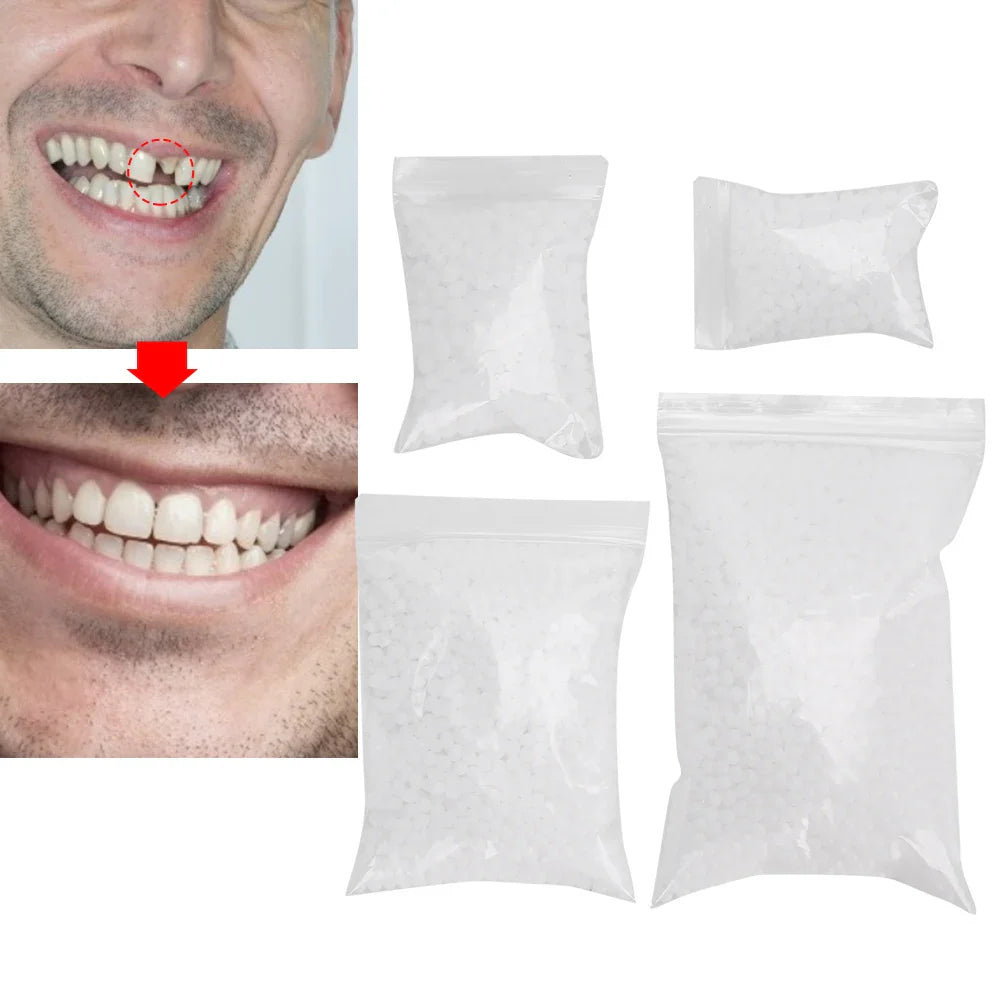 Temporary Tooth Repair Beads – Dental Filling Material for Broken or Missing Teeth