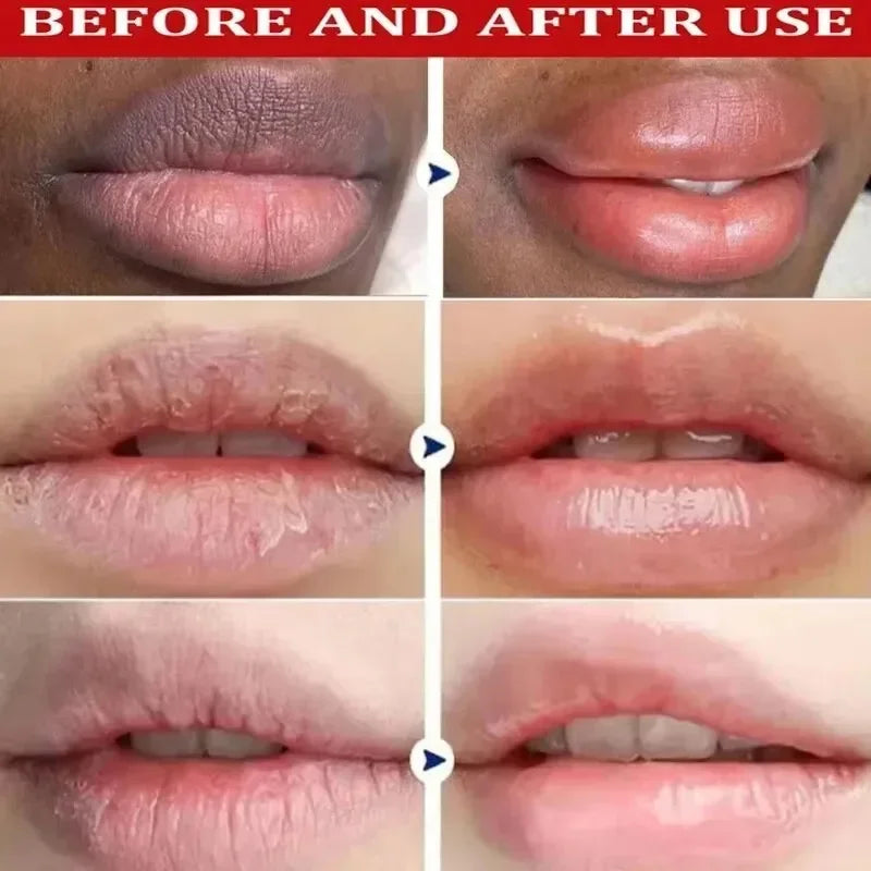 Dark Lip Repair Balm – Moisturizing Exfoliating Lip Treatment for Dry Lips, Fine Lines & Natural Pink Glow