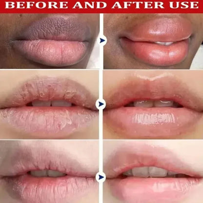 Dark Lip Repair Balm – Moisturizing Exfoliating Lip Treatment for Dry Lips, Fine Lines & Natural Pink Glow