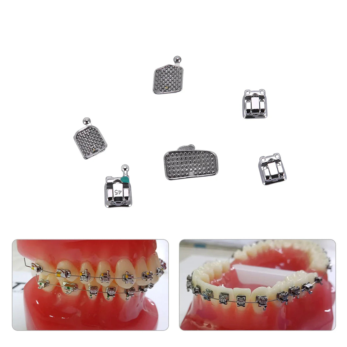 AZDENT 5 Boxes Dental Brackets – Passive Self-Ligating Orthodontic Braces with MIM Monoblock & Buccal Tubes, MBT/Roth 0.022, 345 Hooks