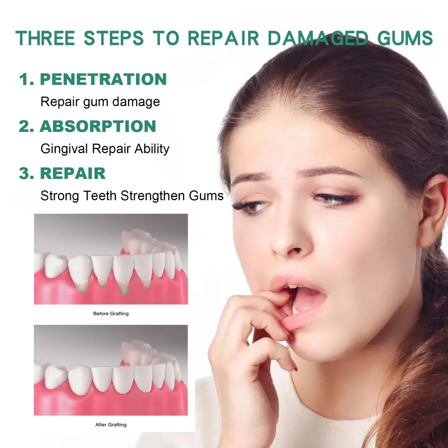 Oral Care Gum Repair Drops – Remove Yellow Stains & Support Periodontal Health