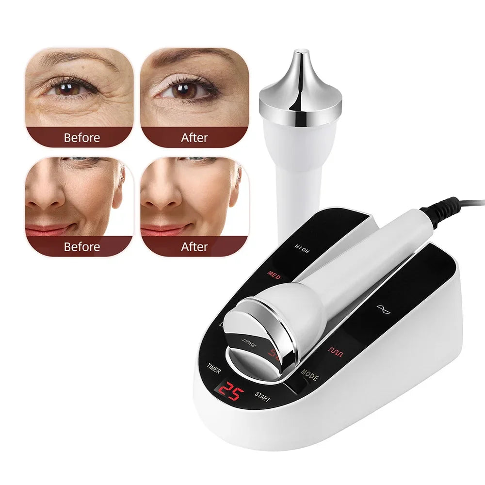 Ultrasound Skin Care Beauty Machine – High-Frequency Facial and Eye Massager for Face Lifting, Deep Cleansing, and SPA Treatment