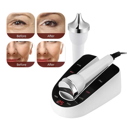Ultrasound Skin Care Beauty Machine – High-Frequency Facial and Eye Massager for Face Lifting, Deep Cleansing, and SPA Treatment