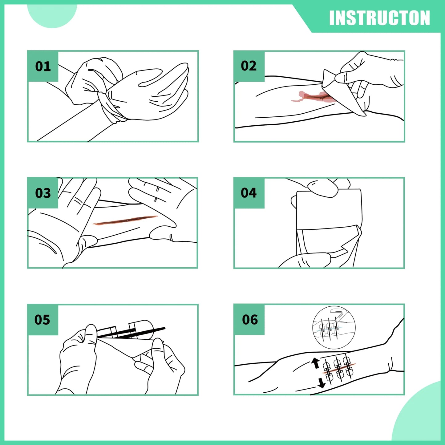 RHINO RESCUE Zip Stitch Laceration Closure Kit — Wound Closure Strips with Dressings, Suture-Free Care